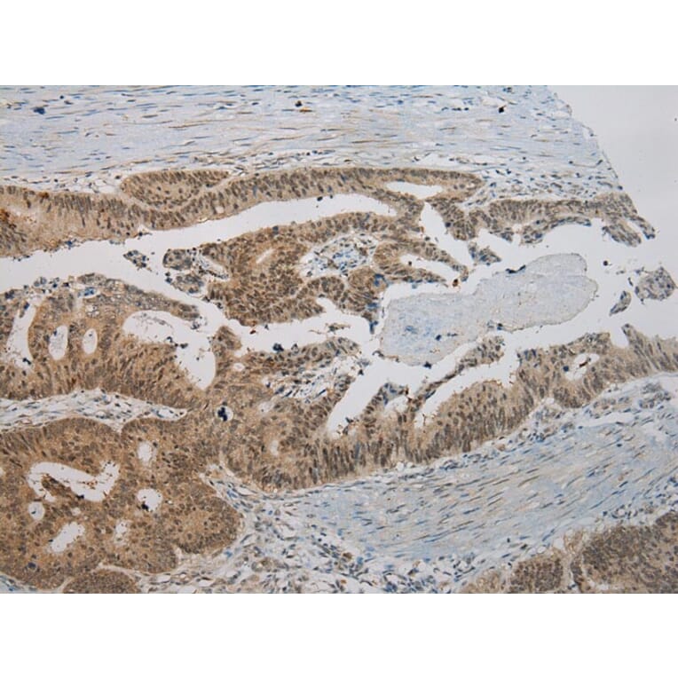 Immunohistochemistry - ROBO3 Antibody from Signalway Antibody (40083) - Antibodies.com