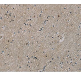 Immunohistochemistry - ROBO4 Antibody from Signalway Antibody (40084) - Antibodies.com