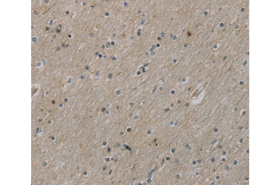 Immunohistochemistry - ROBO4 Antibody from Signalway Antibody (40084) - Antibodies.com