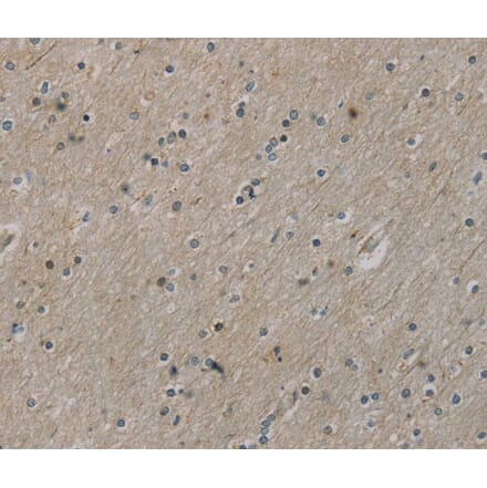Immunohistochemistry - ROBO4 Antibody from Signalway Antibody (40084) - Antibodies.com
