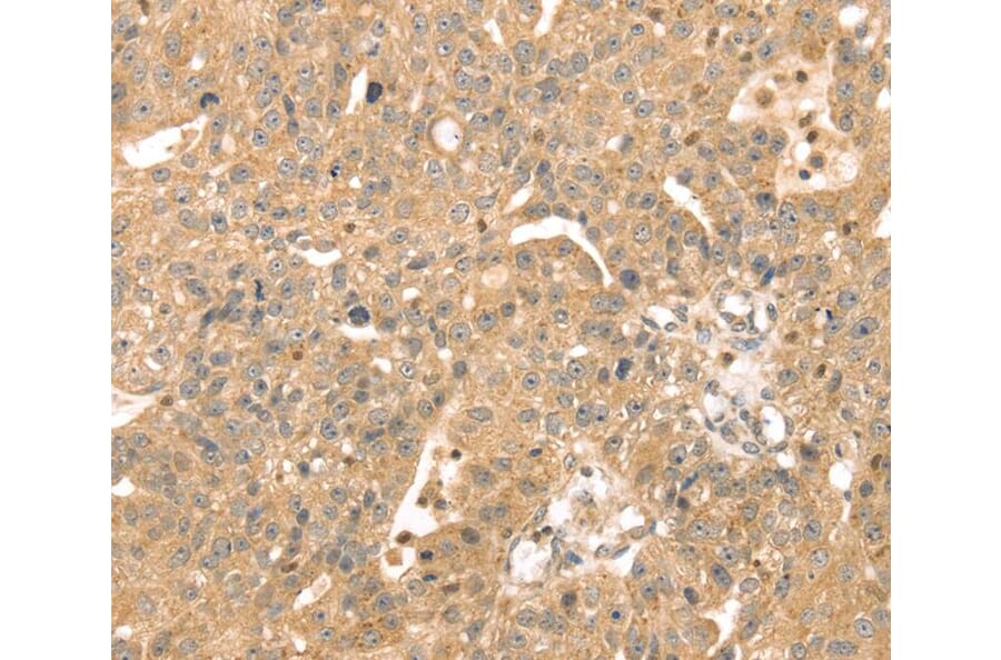 Immunohistochemistry - ATOX1 Antibody from Signalway Antibody (40087) - Antibodies.com