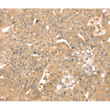 Immunohistochemistry - ATOX1 Antibody from Signalway Antibody (40087) - Antibodies.com