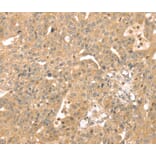 Immunohistochemistry - ATOX1 Antibody from Signalway Antibody (40087) - Antibodies.com