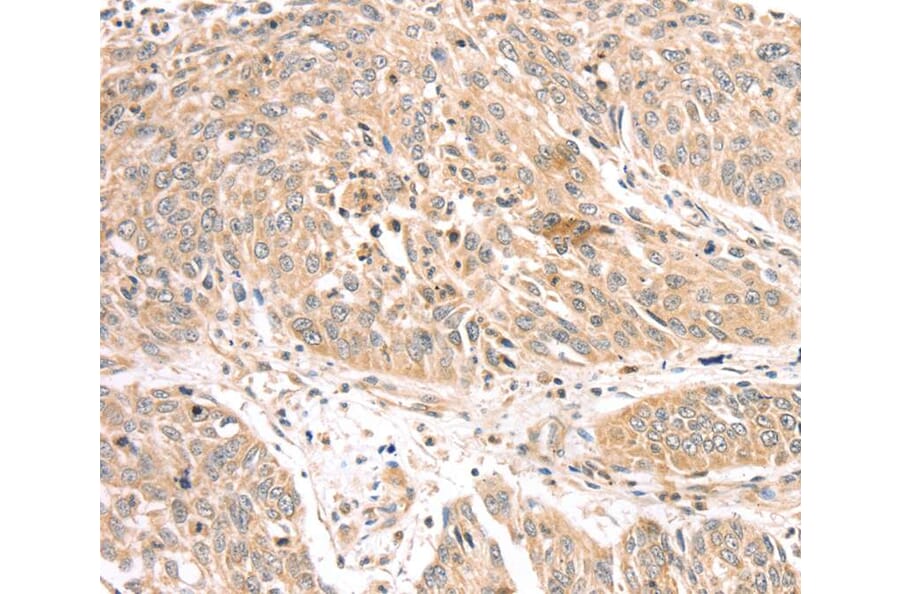 Immunohistochemistry - ATOX1 Antibody from Signalway Antibody (40087) - Antibodies.com