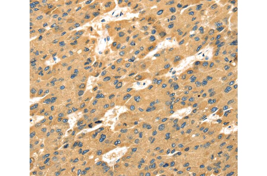 Immunohistochemistry - SAMD7 Antibody from Signalway Antibody (40091) - Antibodies.com