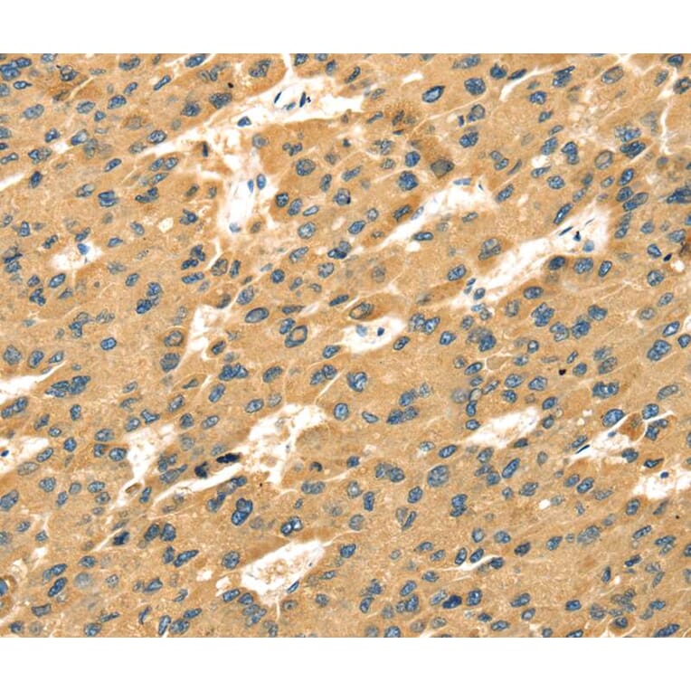Immunohistochemistry - SAMD7 Antibody from Signalway Antibody (40091) - Antibodies.com