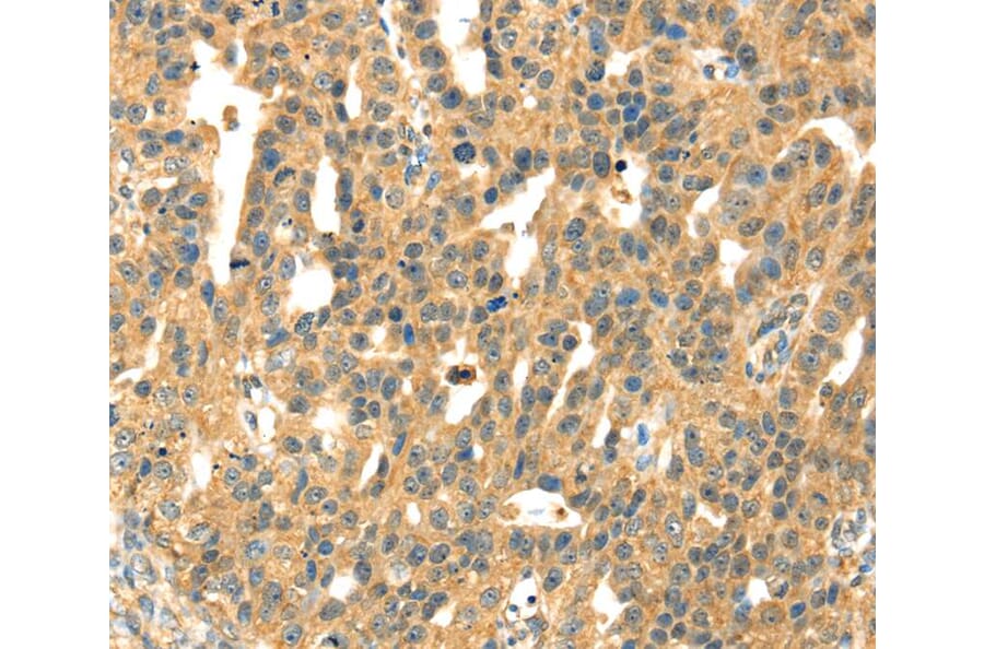 Immunohistochemistry - SAMD7 Antibody from Signalway Antibody (40091) - Antibodies.com