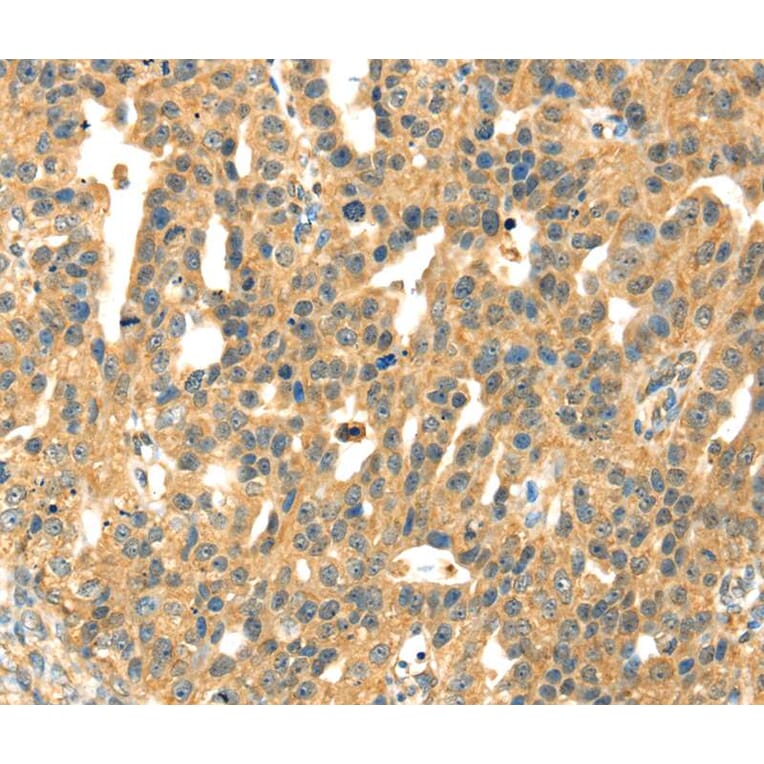 Immunohistochemistry - SAMD7 Antibody from Signalway Antibody (40091) - Antibodies.com