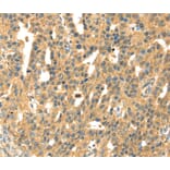 Immunohistochemistry - SAMD7 Antibody from Signalway Antibody (40091) - Antibodies.com