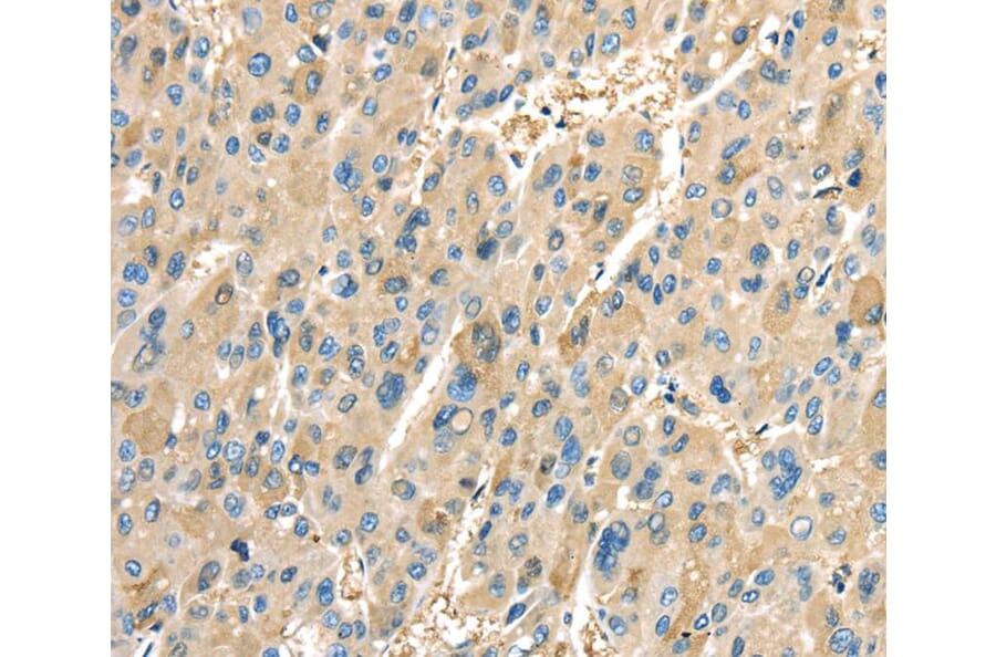 Immunohistochemistry - PTGS2 Antibody from Signalway Antibody (40094) - Antibodies.com