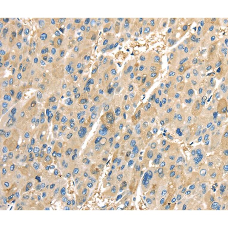 Immunohistochemistry - PTGS2 Antibody from Signalway Antibody (40094) - Antibodies.com