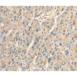 Immunohistochemistry - PTGS2 Antibody from Signalway Antibody (40094) - Antibodies.com