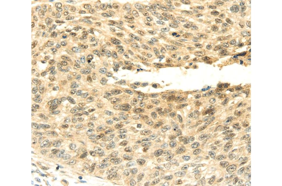 Immunohistochemistry - SHPRH Antibody from Signalway Antibody (40104) - Antibodies.com