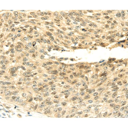 Immunohistochemistry - SHPRH Antibody from Signalway Antibody (40104) - Antibodies.com