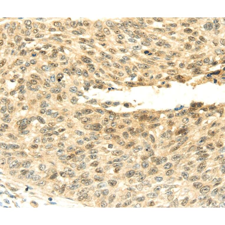 Immunohistochemistry - SHPRH Antibody from Signalway Antibody (40104) - Antibodies.com