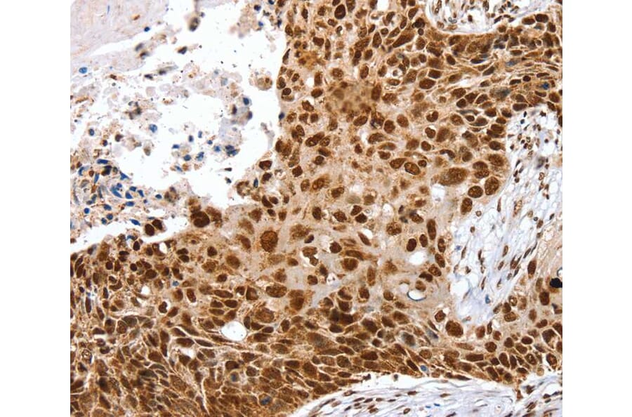 Immunohistochemistry - SNX15 Antibody from Signalway Antibody (40112) - Antibodies.com