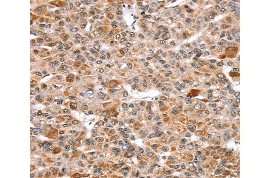 Immunohistochemistry - SNX15 Antibody from Signalway Antibody (40112) - Antibodies.com