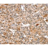 Immunohistochemistry - SNX15 Antibody from Signalway Antibody (40112) - Antibodies.com