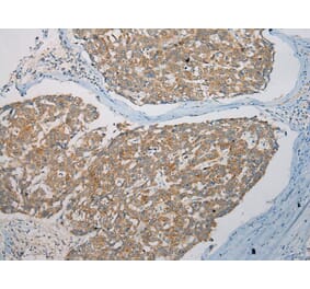 Immunohistochemistry - SNX27 Antibody from Signalway Antibody (40113) - Antibodies.com