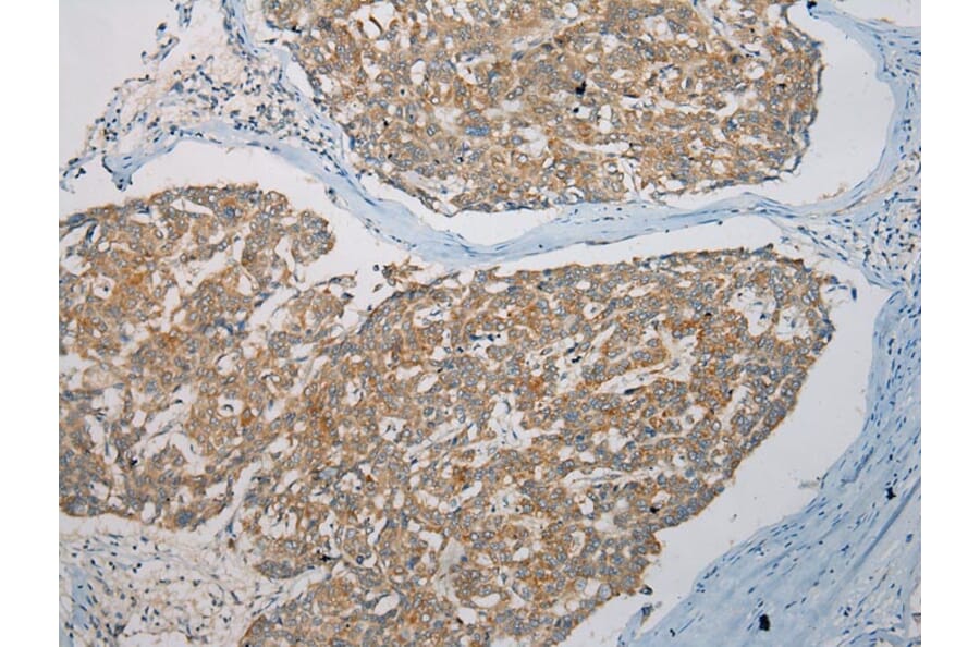 Immunohistochemistry - SNX27 Antibody from Signalway Antibody (40113) - Antibodies.com