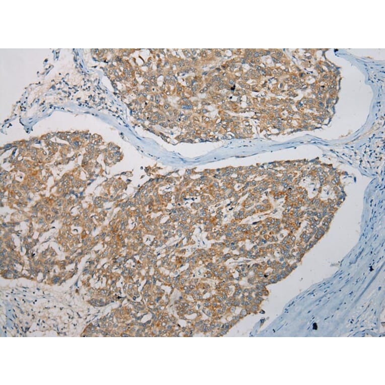 Immunohistochemistry - SNX27 Antibody from Signalway Antibody (40113) - Antibodies.com