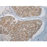 Immunohistochemistry - SNX27 Antibody from Signalway Antibody (40113) - Antibodies.com