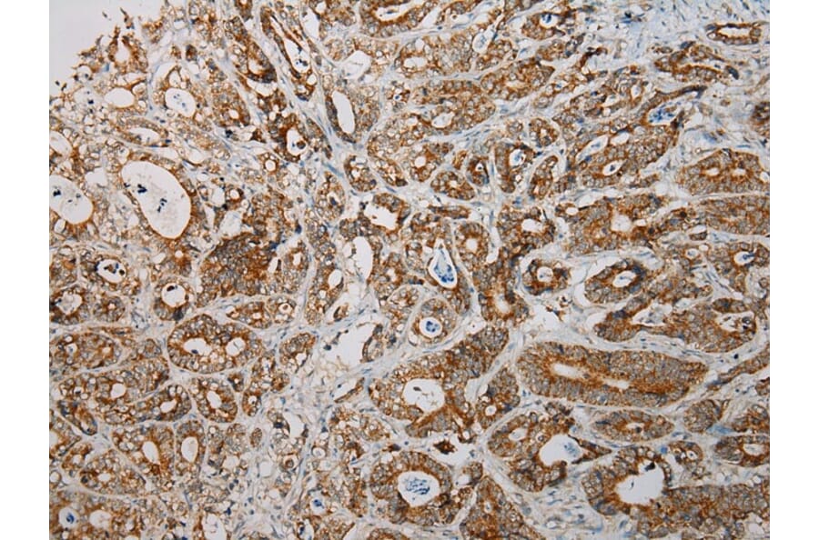 Immunohistochemistry - SNX27 Antibody from Signalway Antibody (40113) - Antibodies.com