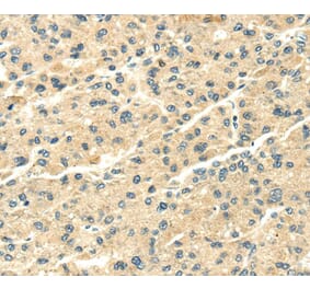 Immunohistochemistry - SNX20 Antibody from Signalway Antibody (40115) - Antibodies.com