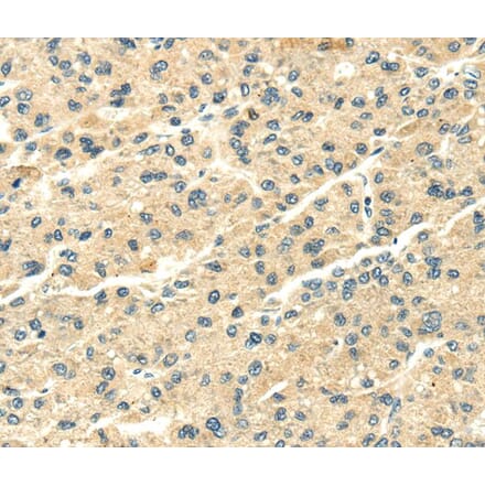 Immunohistochemistry - SNX20 Antibody from Signalway Antibody (40115) - Antibodies.com