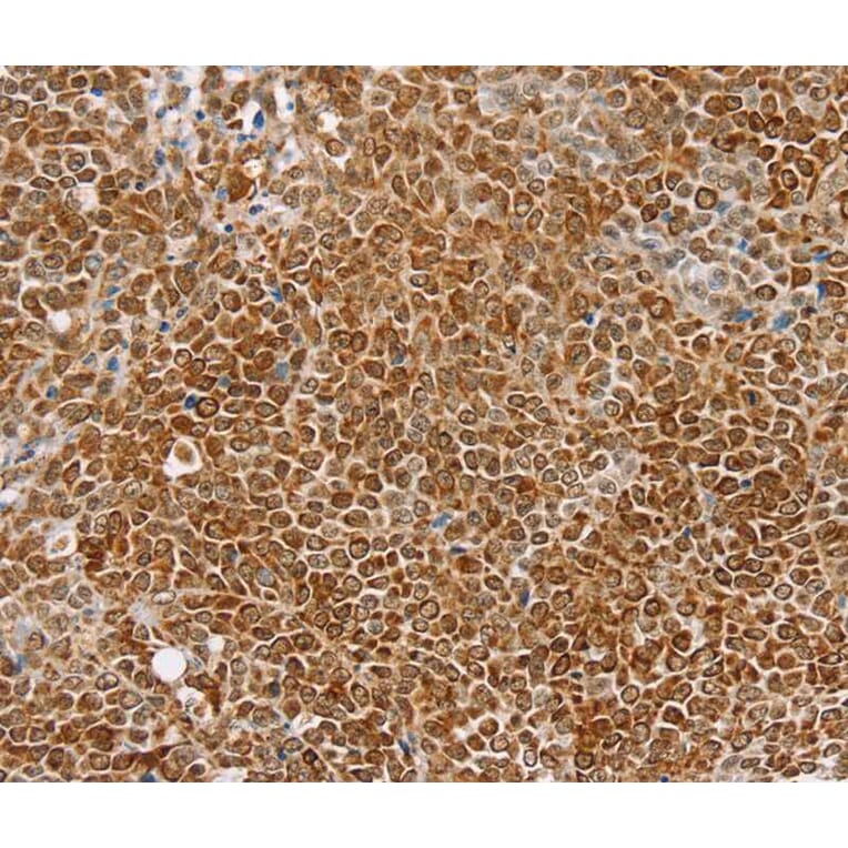 Immunohistochemistry - TAF12 Antibody from Signalway Antibody (40134) - Antibodies.com