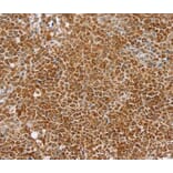 Immunohistochemistry - TAF12 Antibody from Signalway Antibody (40134) - Antibodies.com