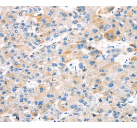 Immunohistochemistry - TBRG1 Antibody from Signalway Antibody (40137) - Antibodies.com