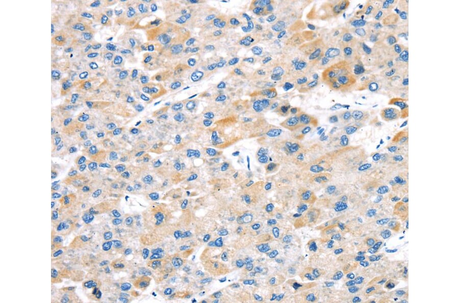 Immunohistochemistry - TBRG1 Antibody from Signalway Antibody (40137) - Antibodies.com