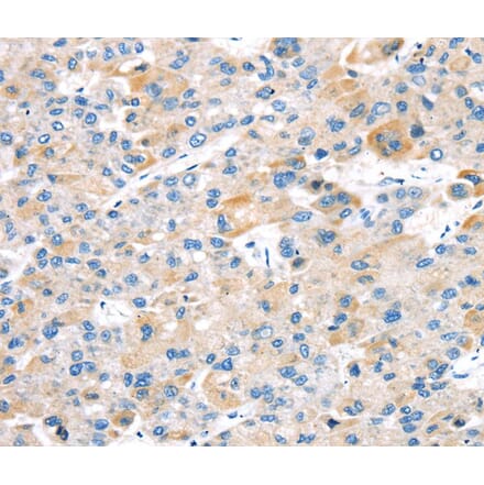 Immunohistochemistry - TBRG1 Antibody from Signalway Antibody (40137) - Antibodies.com