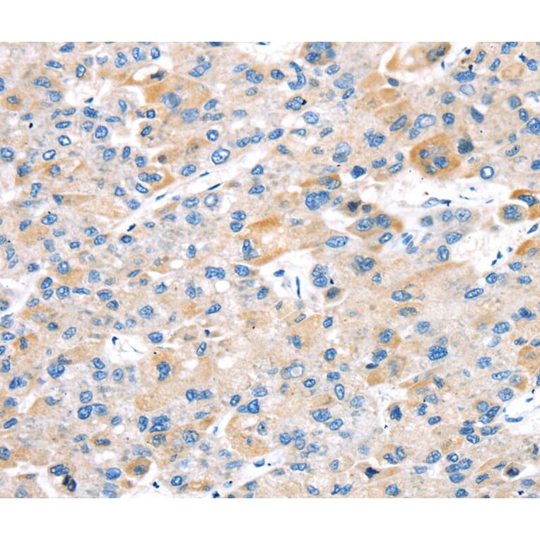 Immunohistochemistry - TBRG1 Antibody from Signalway Antibody (40137) - Antibodies.com