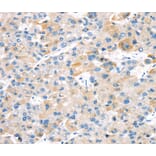 Immunohistochemistry - TBRG1 Antibody from Signalway Antibody (40137) - Antibodies.com