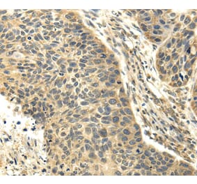 Immunohistochemistry - RASD2 Antibody from Signalway Antibody (40139) - Antibodies.com