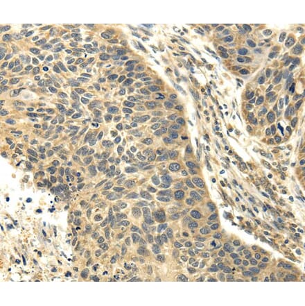 Immunohistochemistry - RASD2 Antibody from Signalway Antibody (40139) - Antibodies.com