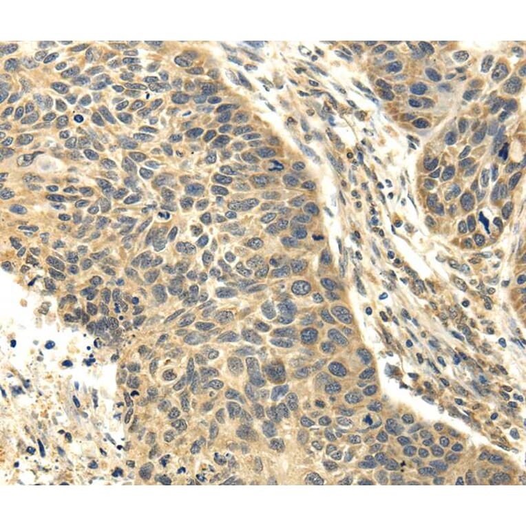Immunohistochemistry - RASD2 Antibody from Signalway Antibody (40139) - Antibodies.com