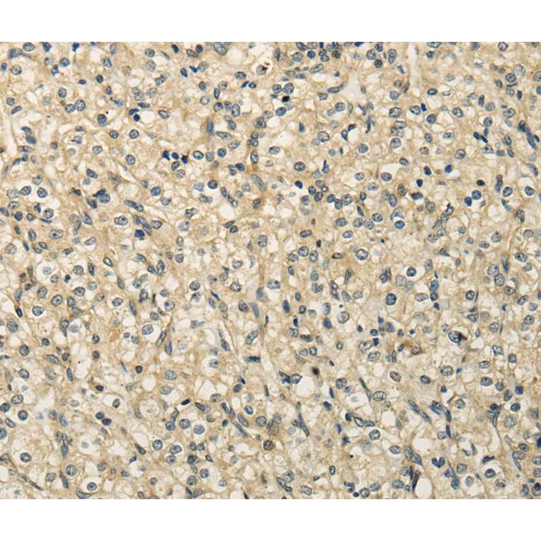 Immunohistochemistry - RASD2 Antibody from Signalway Antibody (40139) - Antibodies.com