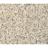 Immunohistochemistry - RASD2 Antibody from Signalway Antibody (40139) - Antibodies.com