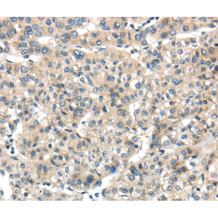 Immunohistochemistry - THAP2 Antibody from Signalway Antibody (40141) - Antibodies.com