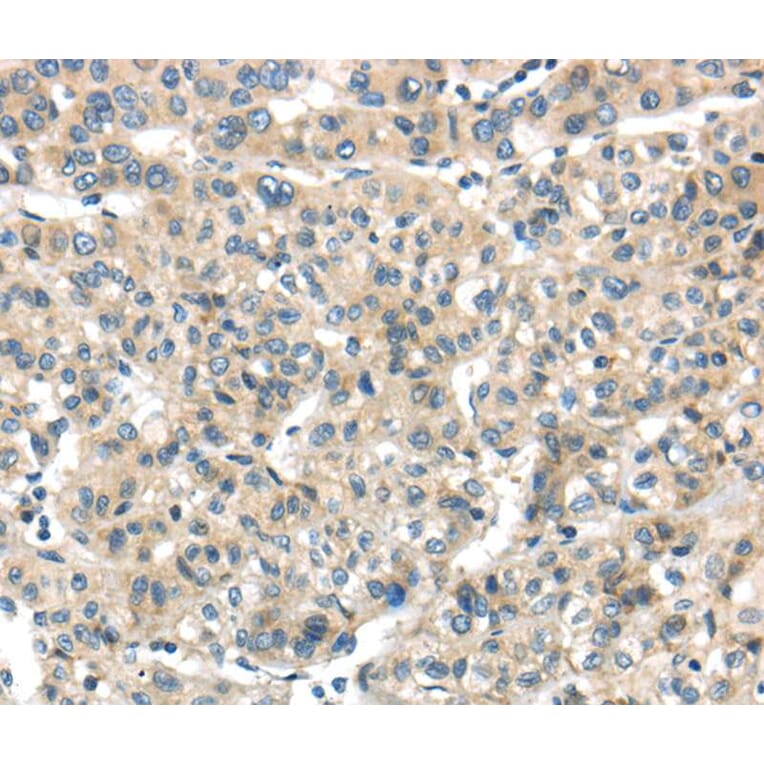 Immunohistochemistry - THAP2 Antibody from Signalway Antibody (40141) - Antibodies.com