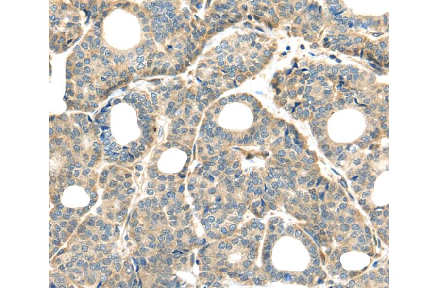Immunohistochemistry - THAP2 Antibody from Signalway Antibody (40141) - Antibodies.com