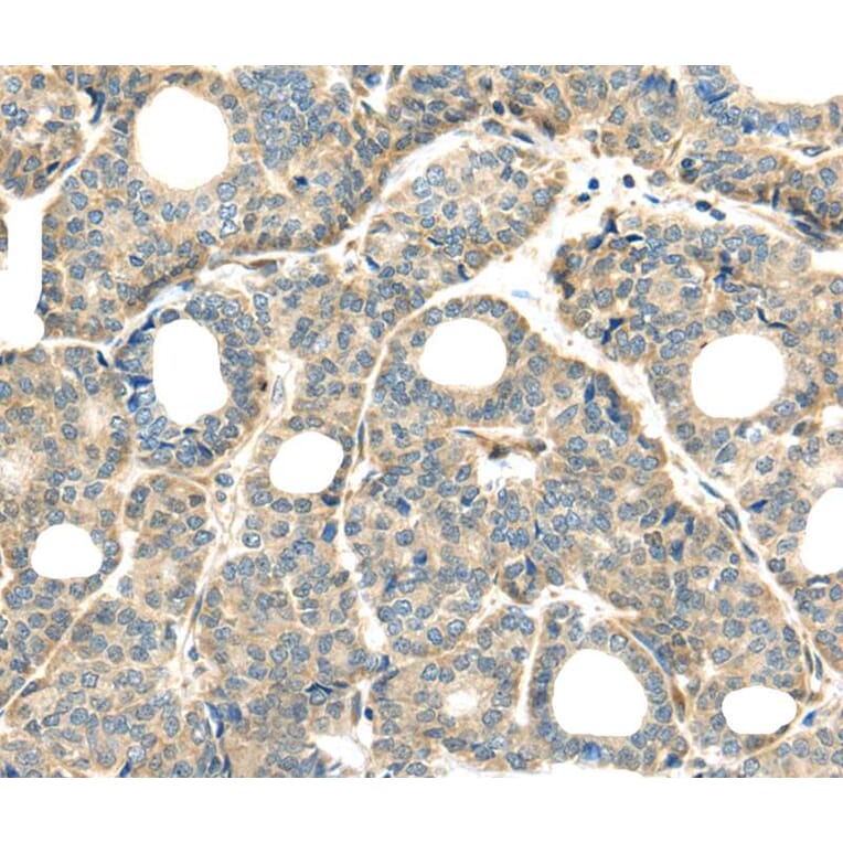 Immunohistochemistry - THAP2 Antibody from Signalway Antibody (40141) - Antibodies.com
