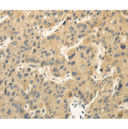 Immunohistochemistry - MED16 Antibody from Signalway Antibody (40144) - Antibodies.com