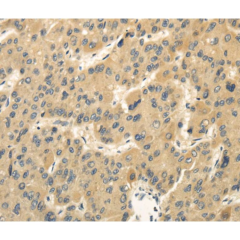 Immunohistochemistry - MED16 Antibody from Signalway Antibody (40144) - Antibodies.com