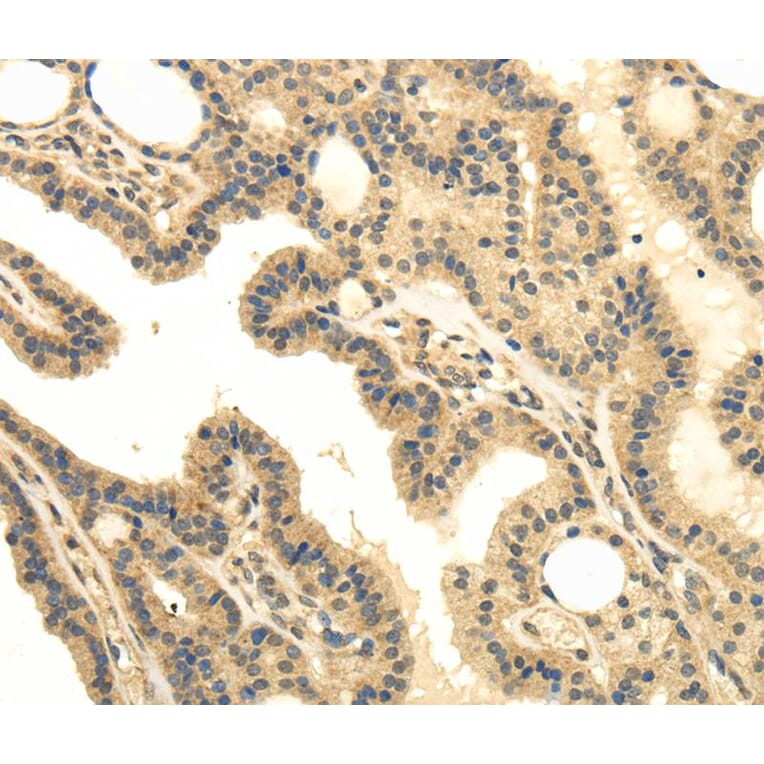 Immunohistochemistry - MED16 Antibody from Signalway Antibody (40144) - Antibodies.com