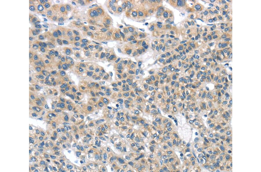 Immunohistochemistry - THSD1 Antibody from Signalway Antibody (40145) - Antibodies.com