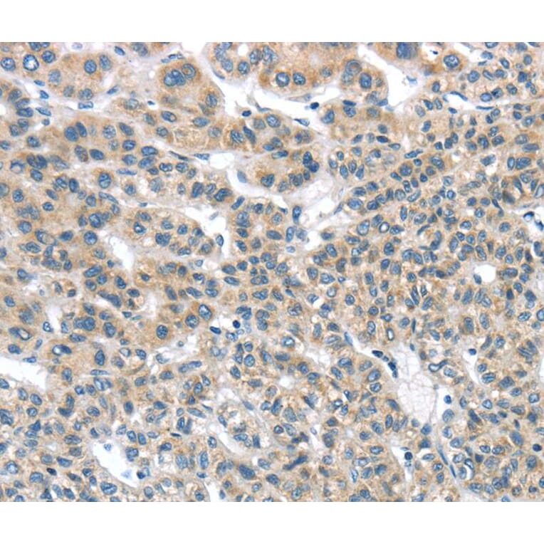 Immunohistochemistry - THSD1 Antibody from Signalway Antibody (40145) - Antibodies.com